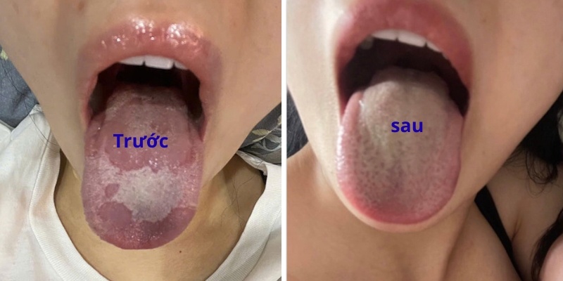 Chị Mỹ Vân - Hải Châu, Đà Nẵng